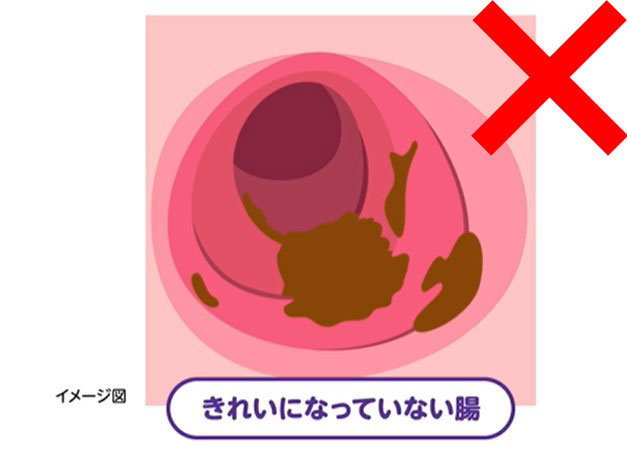 洗腸剤(下剤)のイメージ
